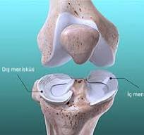 - Akut Yaralanmalar: 

Dizin ani dönme, bükülme veya çökme hareketleri sırasında menisküs yırtılabilir. Bu genellikle sporcularda, özellikle futbol oyuncularında görülür.

- Dejeneratif Yıpranma: 

İlerleyen yaşla birlikte menisküslerde kıkırdak hasarı ve dejenerasyon meydana gelebilir.