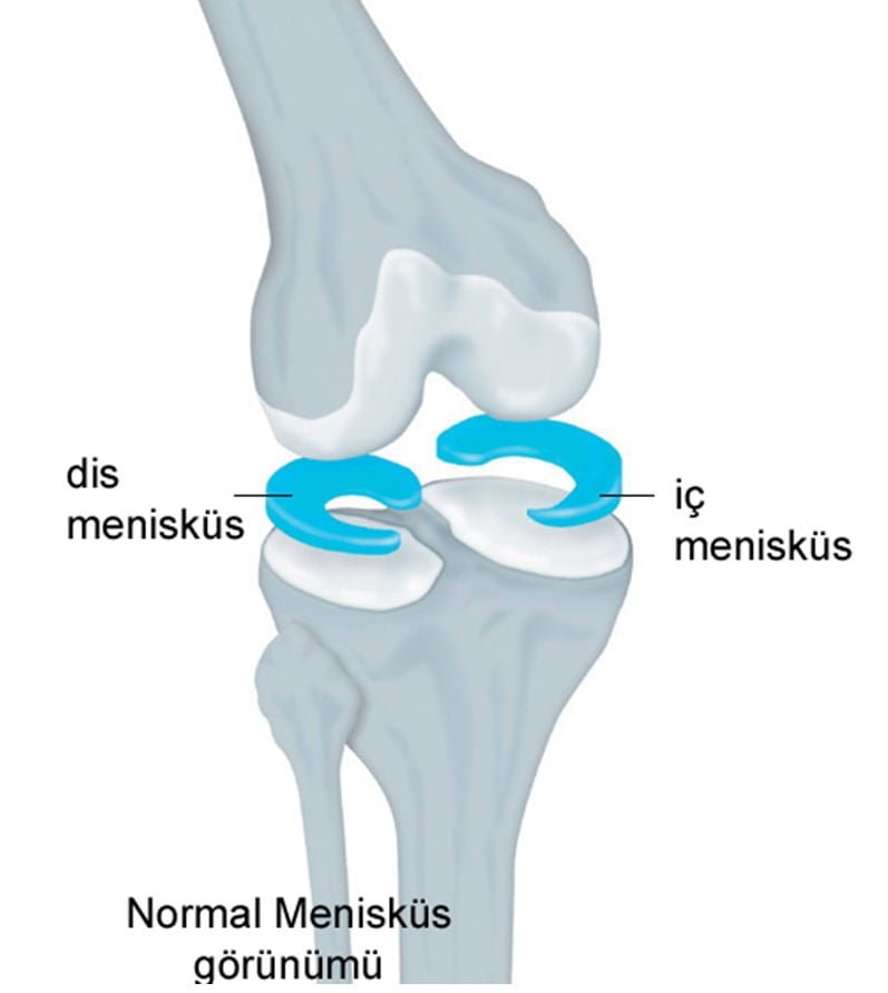 Menisküsler, diz ekleminde bulunan C şeklindeki kıkırdak yapılar olarak bilinir. Dizde iki menisküs bulunur: iç menisküs (medial) ve dış menisküs (lateral). Bu yapılar, eklem yüzeyini korurken aynı zamanda stabilite sağlar ve yükleri emer.